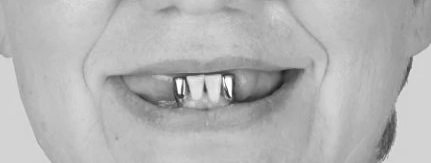 FuturaDental - 326