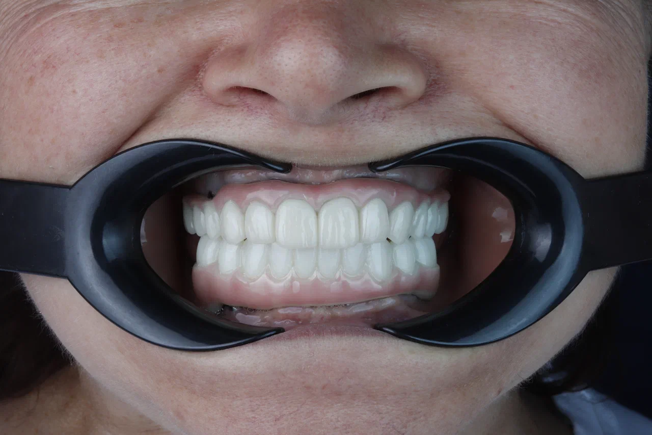 FuturaDental - 341